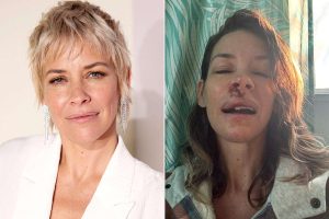 Evangeline Lilly dezvăluie leziuni cerebrale și funcții reduse după o contuzie