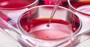 Oamenii de știință descoperă un mecanism anti-leucemie agresivă