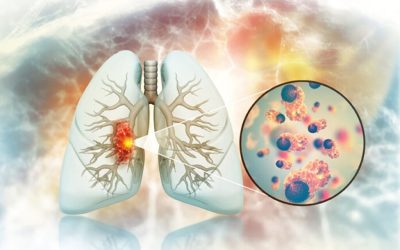 Cancerul de plămâni la nefumători: Legătura șocantă cu legumele și fructele?