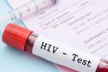 Bărbat din Europa, vindecat de HIV fără medicamente. Un caz rar