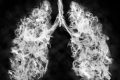 E-țigările, pericol ascuns: Cancer pulmonar și oral garantat?