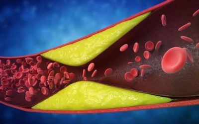 Avertisment de la medici: 7 semne că arterele sunt blocate. Le ignori?