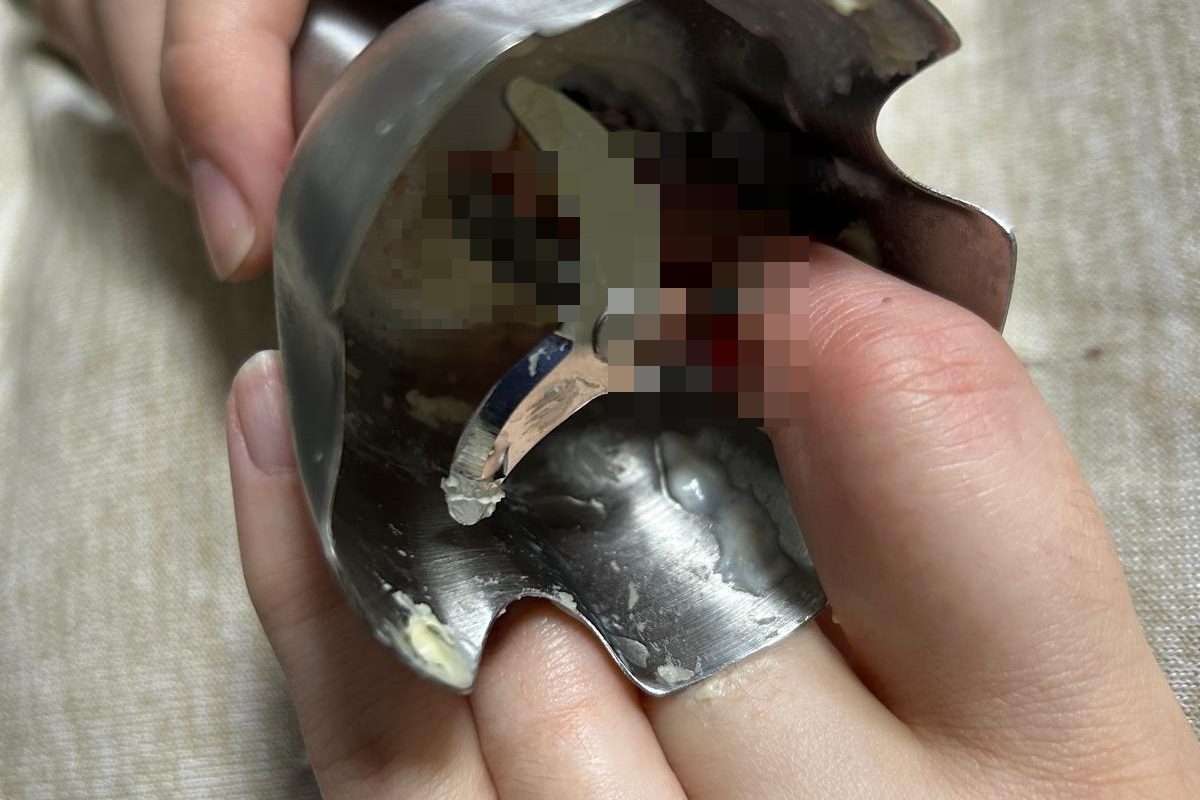 Două femei din Iași, victime ale unor accidente casnice grave și ajung la spital