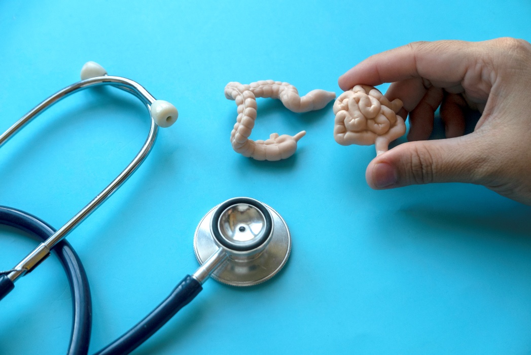 Cancerul de colon lovește tinerii. De ce e un fenomen global îngrijorător