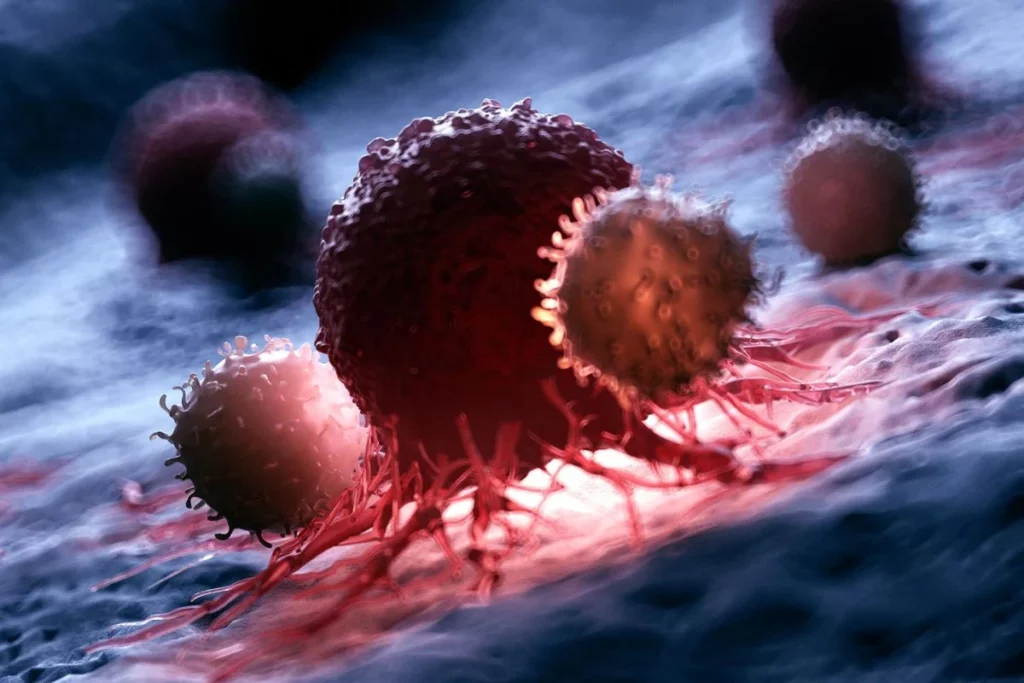 Cancerul învins prin imunoterapie: „Science fiction”, spune un expert