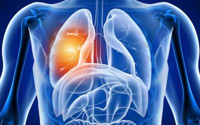 Răni ascunse: Ce suferă plămânii după COVID-19 în România