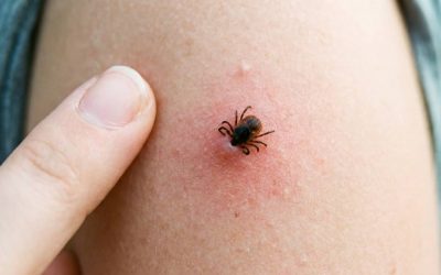Cum te aperi de insecte: Țânțari, căpușe, păienjeni. Sfaturi utile