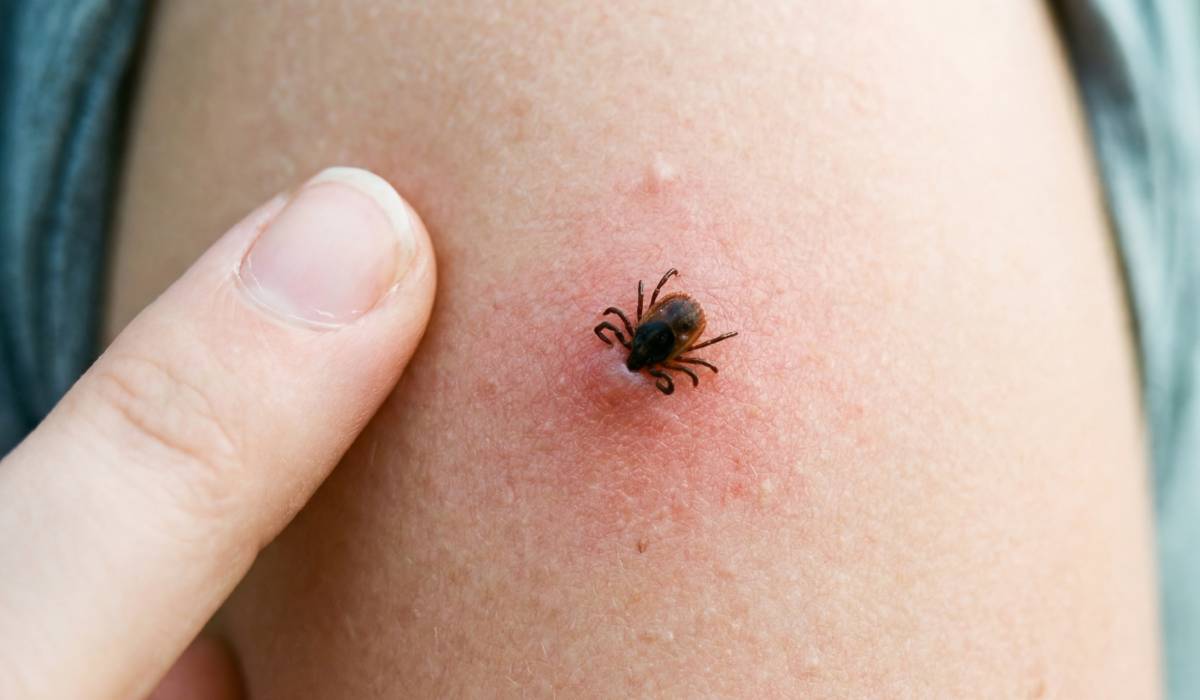 Cum te aperi de insecte: Țânțari, căpușe, păienjeni. Sfaturi utile