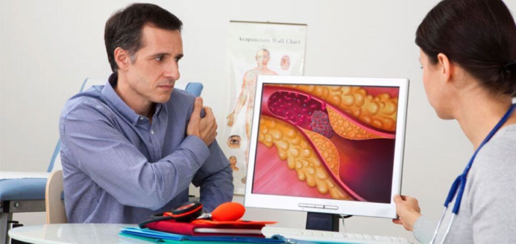 Noua alarmă: Cardiologii americani trag semnalul de alarmă privind colesterolul, infarctul și avc