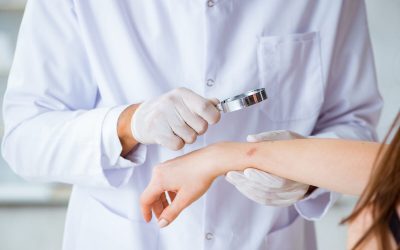 Ectima: Cauze, simptome și tratament. Află cum te ferești de infecție