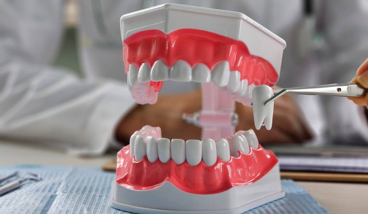 Extracție sau nu în ortodonție? Medicii explică DE CE decid așa