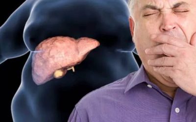 Boala ficatului gras, tratată fără dietă. Descoperirea FACE valuri în cercetare