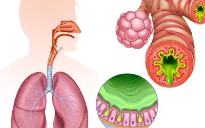 Inflamația cronică, inamicul ascuns al sănătății: Cum ne afectează viața
