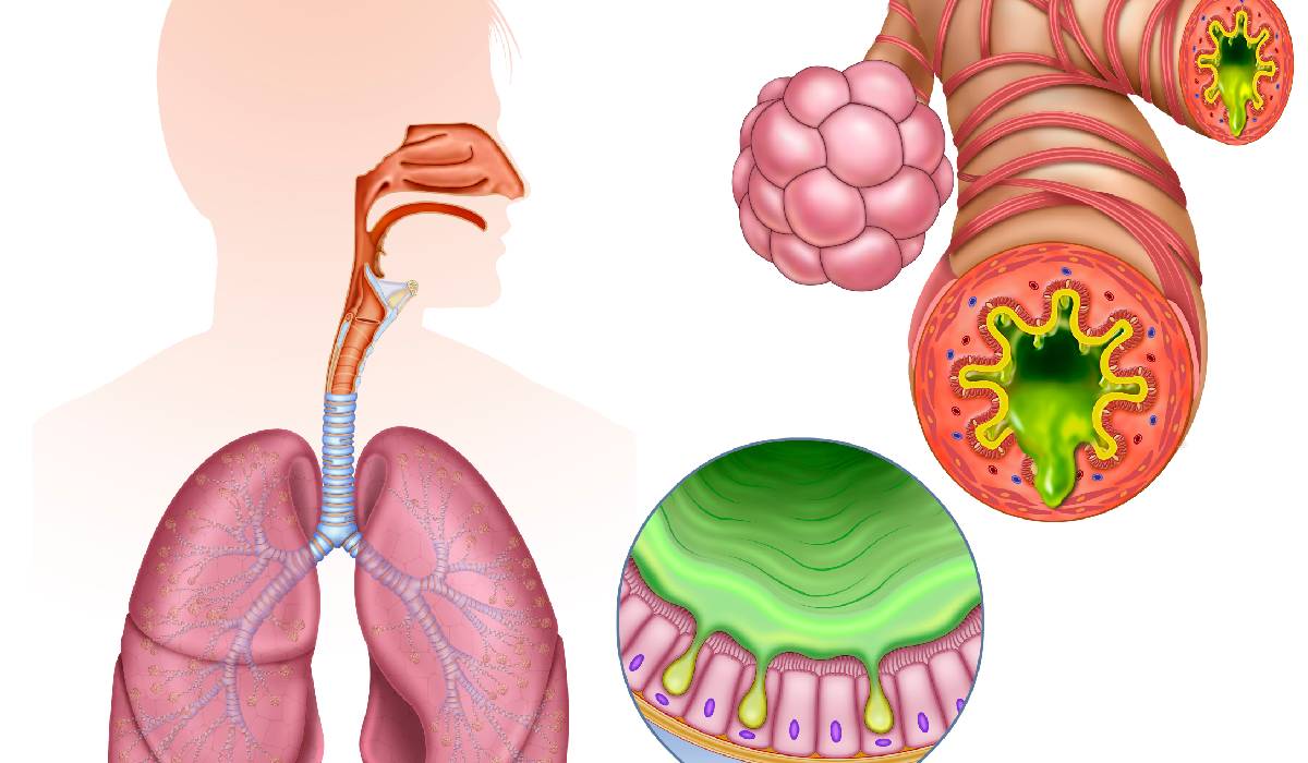 Inflamația cronică, inamicul ascuns al sănătății: Cum ne afectează viața