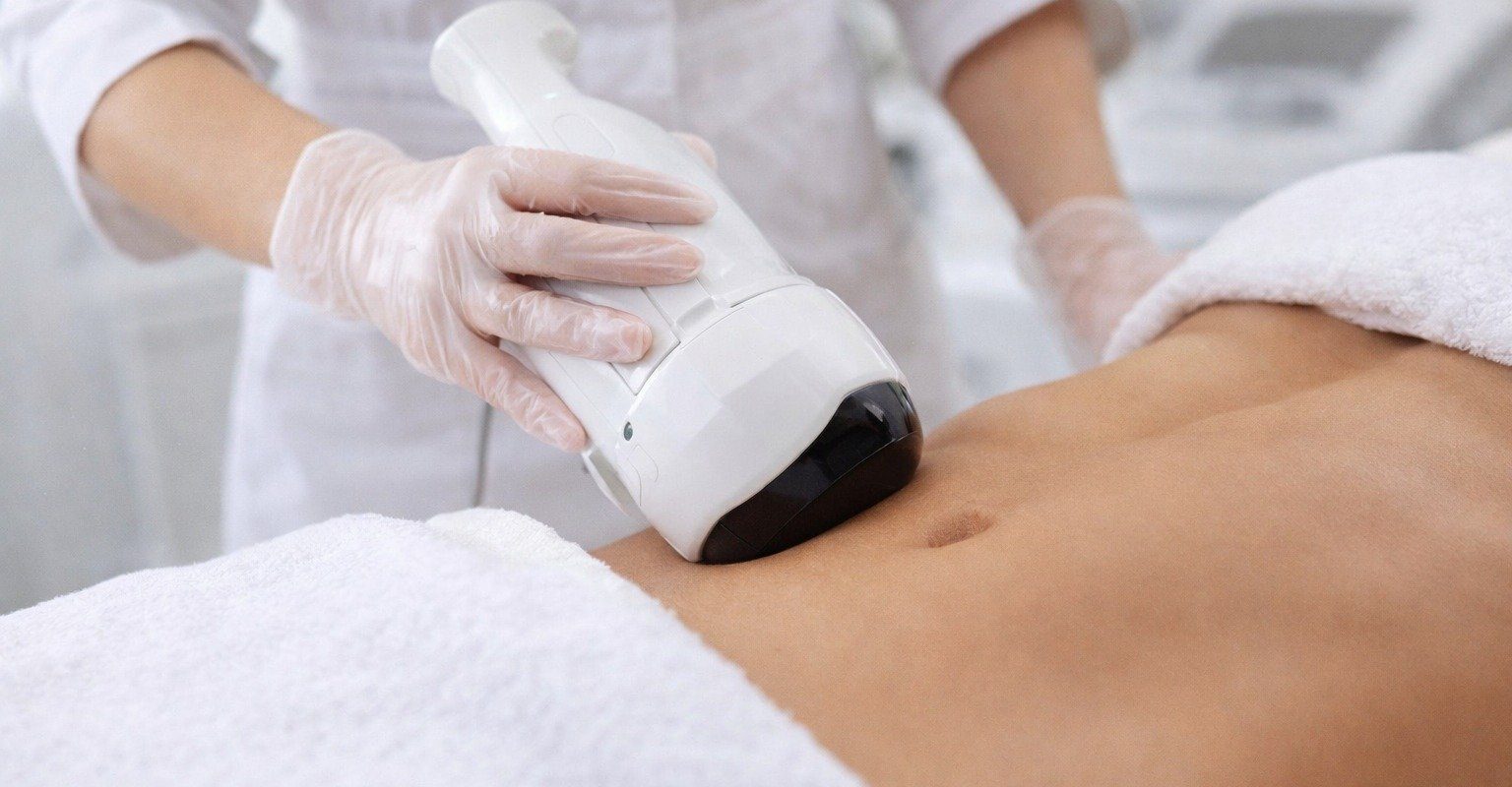 Liposonix: Slăbești fără bisturiu! Cum funcționează și cui i se potrivește
