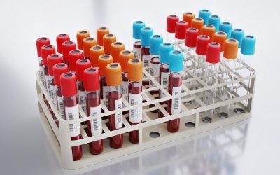 Analiză de sânge revoluționară: Identifică riscul de infarct!