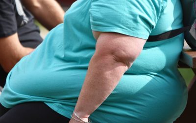 Obezitatea la 30 de ani crește șansele de deces cu 70%