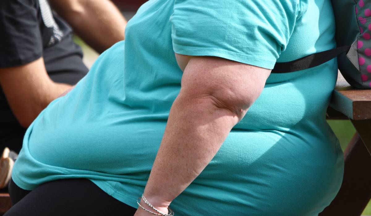 Obezitatea la 30 de ani crește șansele de deces cu 70%