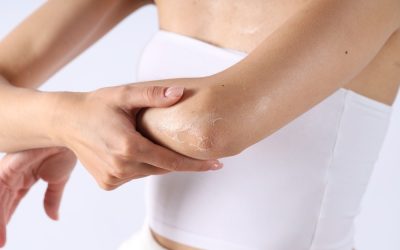 Piele uscată pe brațe și picioare? 5 obiceiuri care agresează epiderma