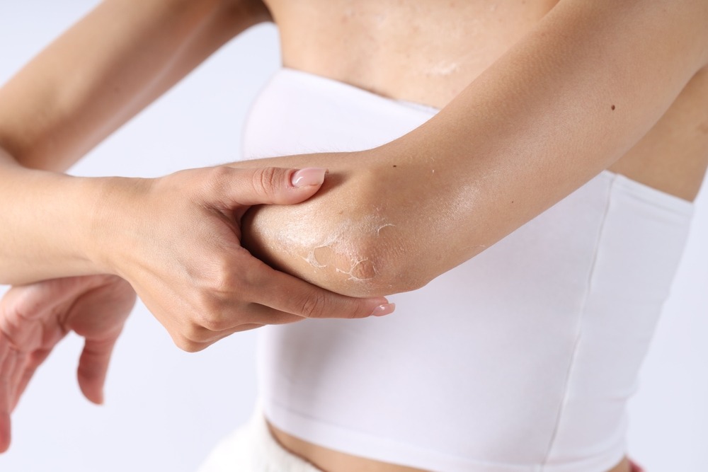 Piele uscată pe brațe și picioare? 5 obiceiuri care agresează epiderma