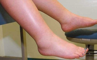 Leguma minune: Spune adio picioarelor umflate și circulației proaste