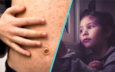 Rujeolă, gripă, vaccinare: Dr. Alexiu despre dramele din România