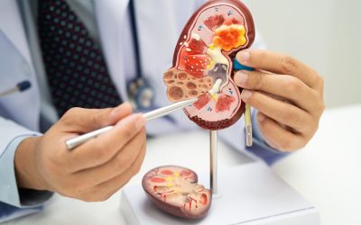 Acid uric vs. Creatinină: Ce secrete ascund analizele rinichilor