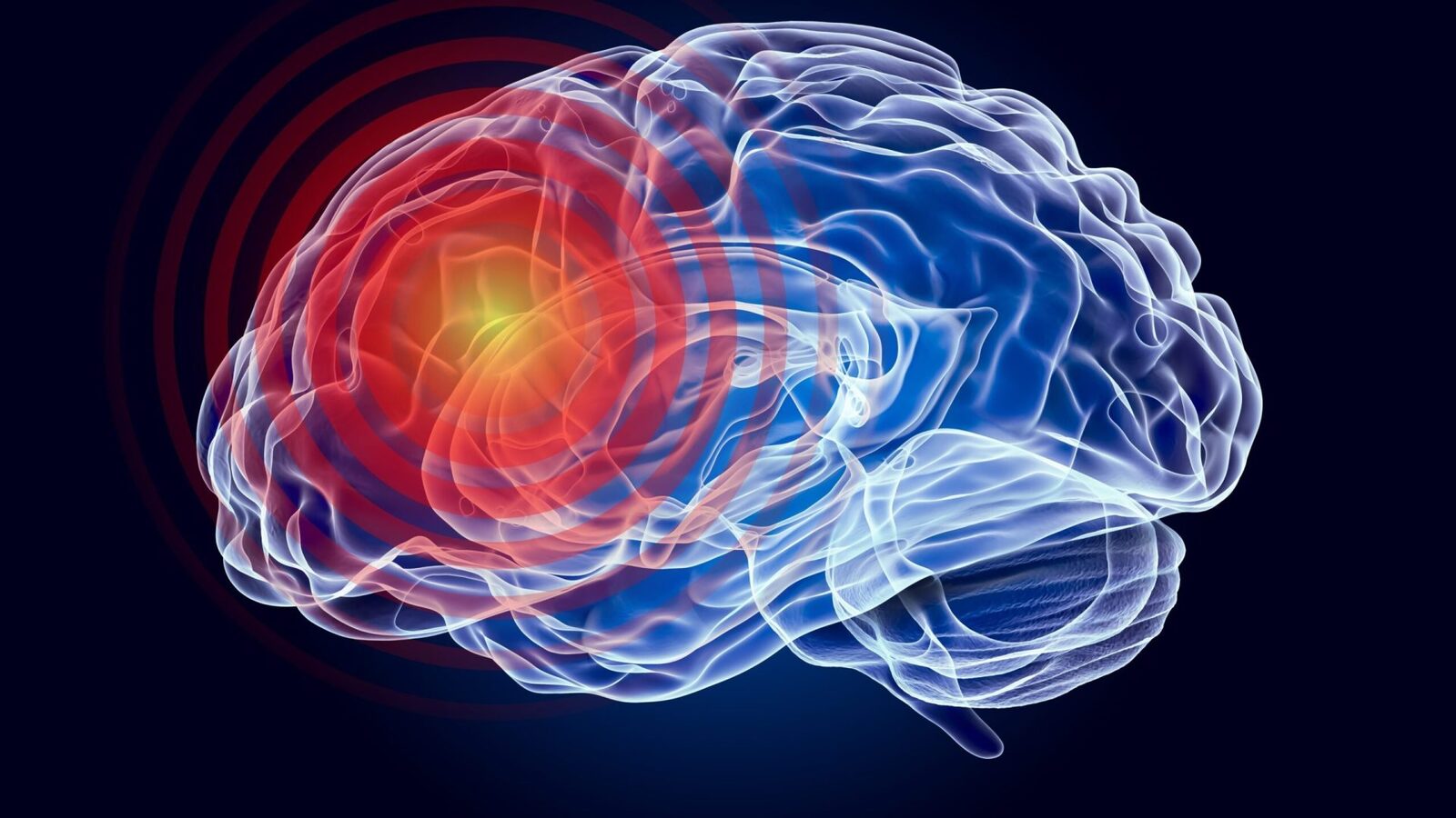 Nouă afecțiune neurologică face ravagii: Cercetătorii au descoperit-o