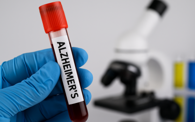 Alzheimer, contagios prin sânge: Noi indicii uimitoare