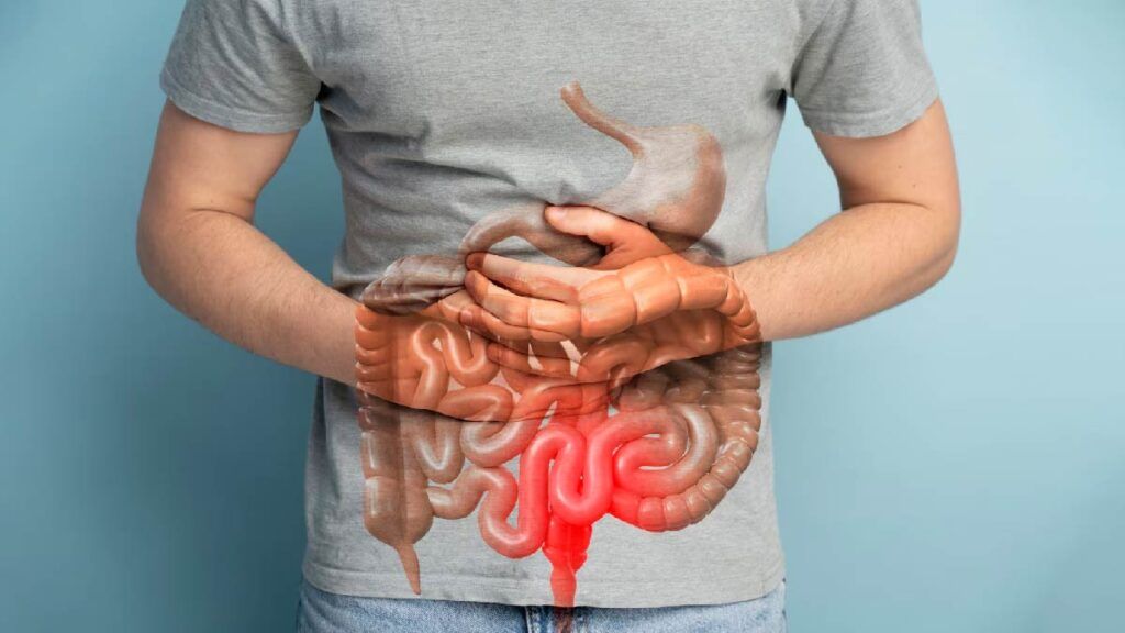 Cancer de colon: A ignorat 10 ani un simptom banal