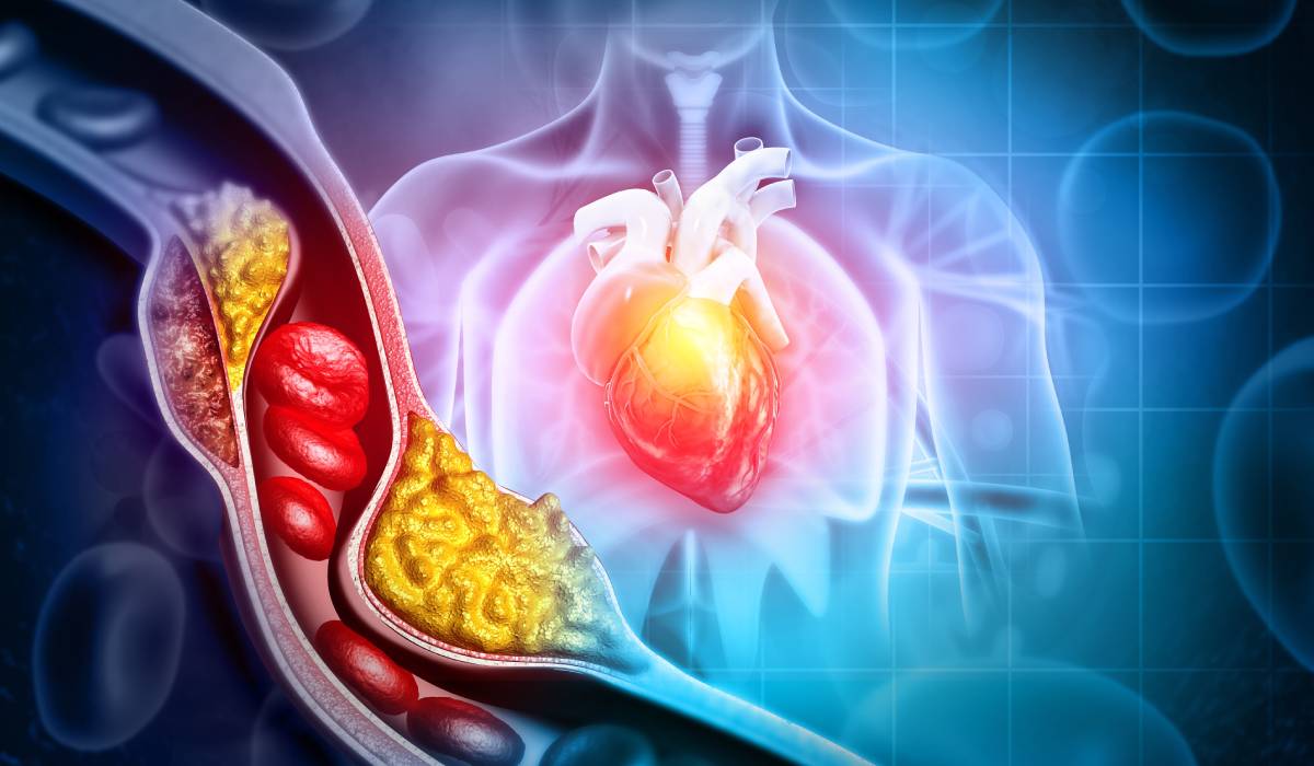 Infarct cu colesterol normal? Medicii explică riscul ascuns