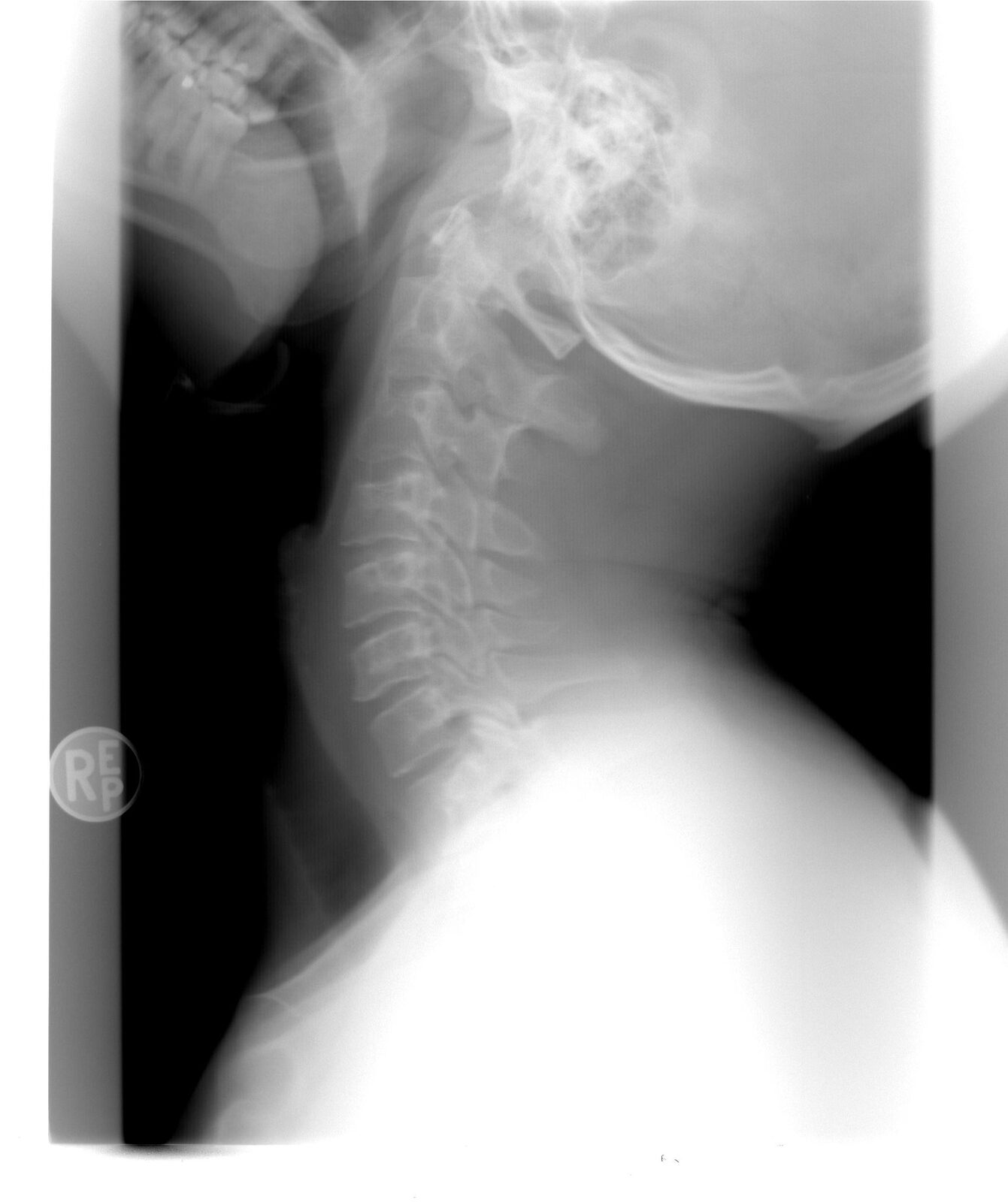 AI ajută radiologii de la Bihor la imagini medicale