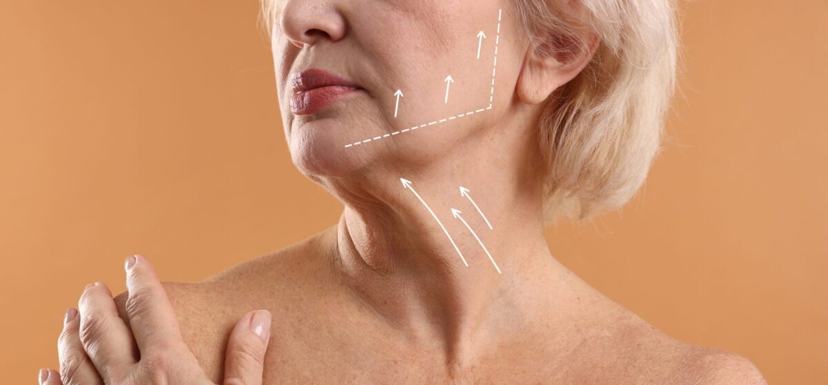 Gâtul tău necesită chirurgie? Când liftingul e singura soluție
