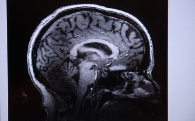 Creierul: Oxitocina și frica, zone noi de descoperire