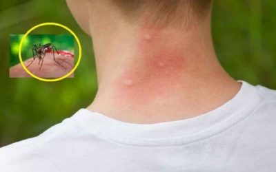 Țânțarii te aleg pe tine? Descoperite 3 bacterii ce-i atrag