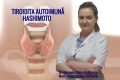 Boală tăcută: Ce afectează femeile și dă bătăi de cap