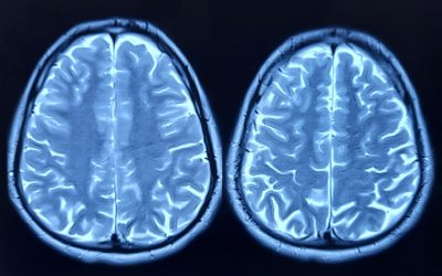 Craniu ascunde un nou organ al sistemului imunitar
