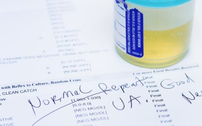 Test urină: 9 din 10 cancere vezică detectate
