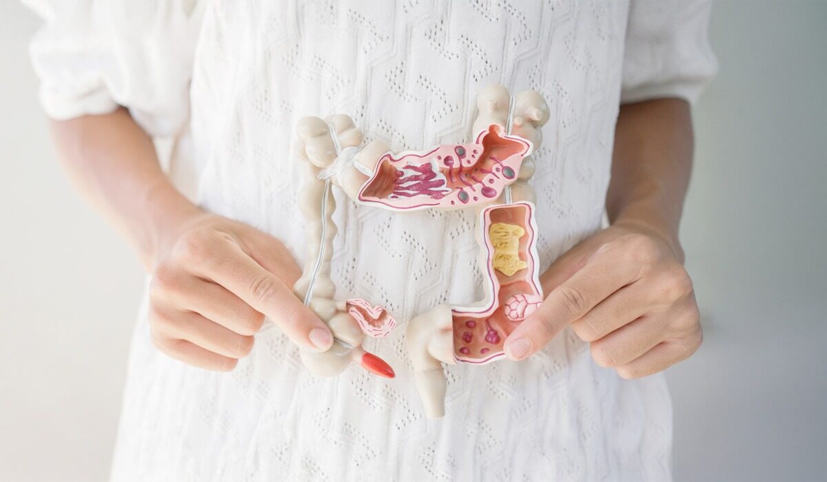 Chefirul: Secretul florei intestinale, explicat pe înțelesul tău