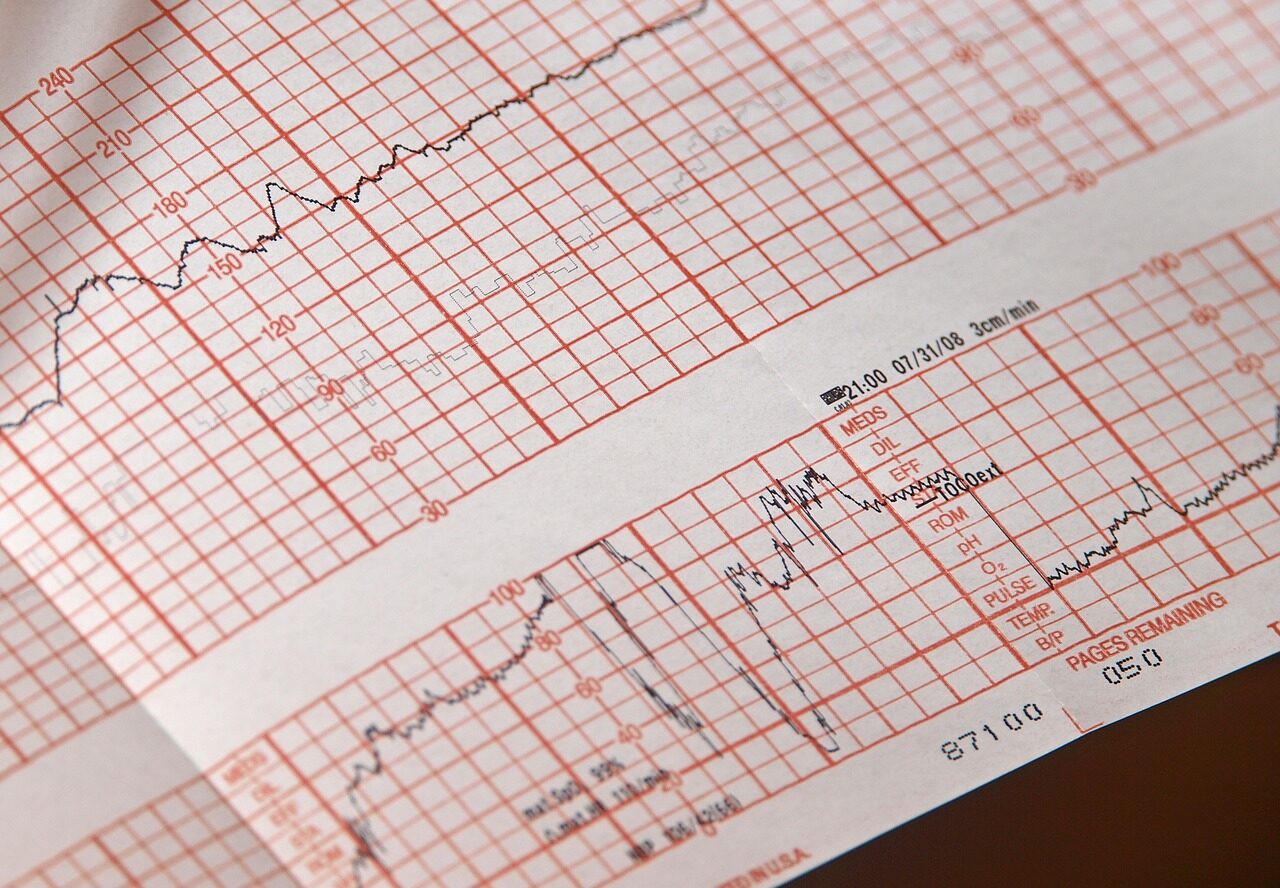 Somnul dezvăluie bolile de inimă cu ani înainte